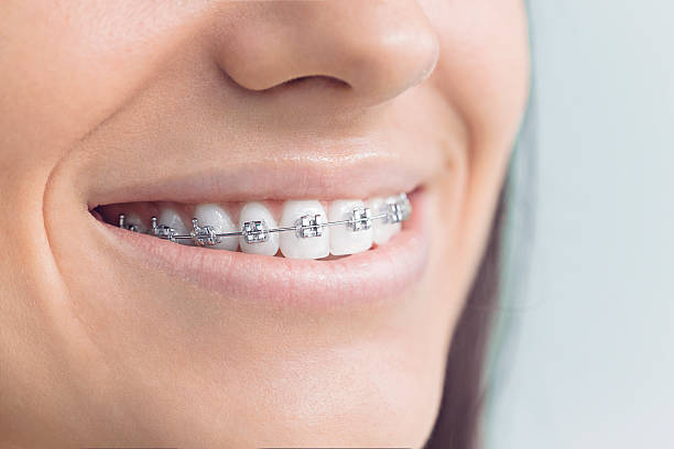 Best Teeth Whitening  in Holiday Valley, OH